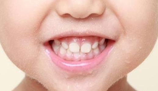 成人蛀牙真实案例视频大全,牙齿健康警示录