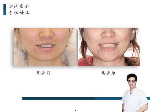 成人整牙拔牙过程视频,视频解析与专业解读