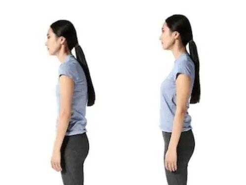 成人模特驼背图片高清视频,成人模特驼背矫正之道