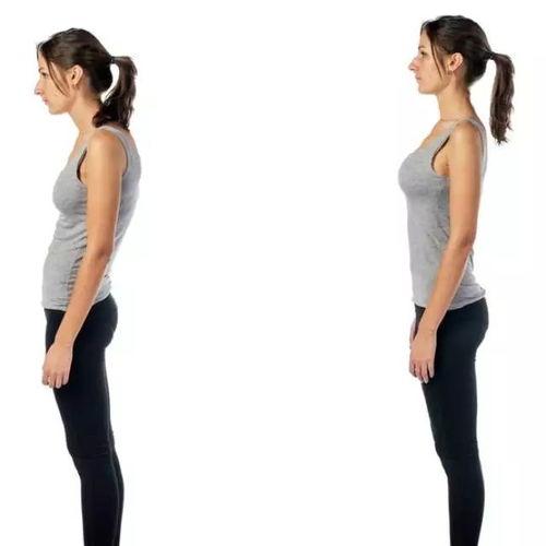 成人模特驼背图片高清视频,成人模特驼背矫正之道